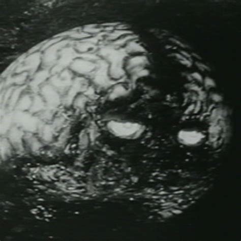 Stream Naked Nazi Coeds From Outer Space By Ancient Eyeball Recipe