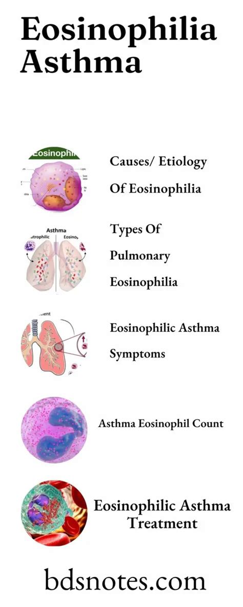 Eosinophilia Asthma Treatment Bds Notes