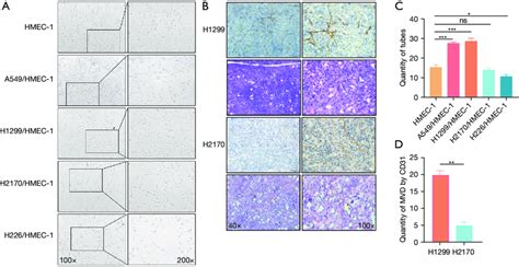 Luad Cells Promoted Angiogenesis More Efficiently Than Did Lusc Cells