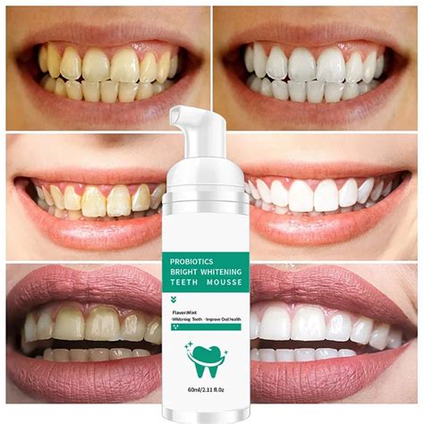 Teeth Whitening Foam Creme Dental Poderoso Whitening Sem Sensibilidade