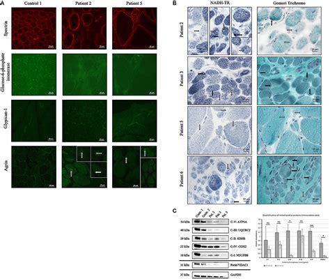 Frontiers Identification Of Candidate Protein Markers In Skeletal