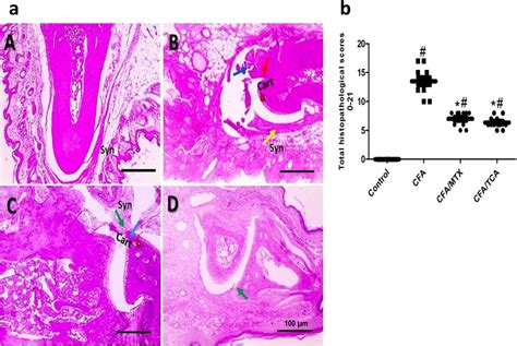 TCA Alleviated CFA Induced Structural Alteration In Hind Paw Joints