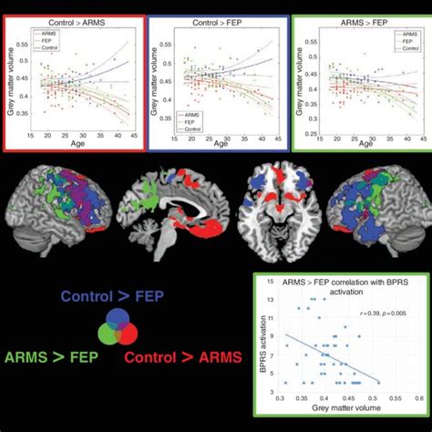 Voxel Based Morphometry Interaction Analyses With Age Top Regions