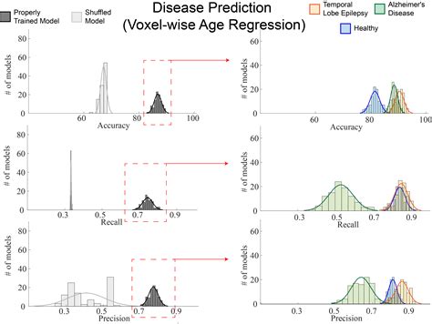 Identification-of-MRI-Features-of-Temporal-Lobe-Epilepsy-with-Deep-Learning