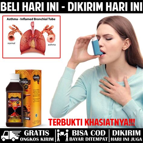 Jual Solusi Untuk Obat Asma Sesak Nafas Batuk Batuk Berdahak Batuk