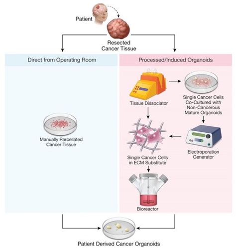 Patient Derived Cancer Organoids Encyclopedia Mdpi