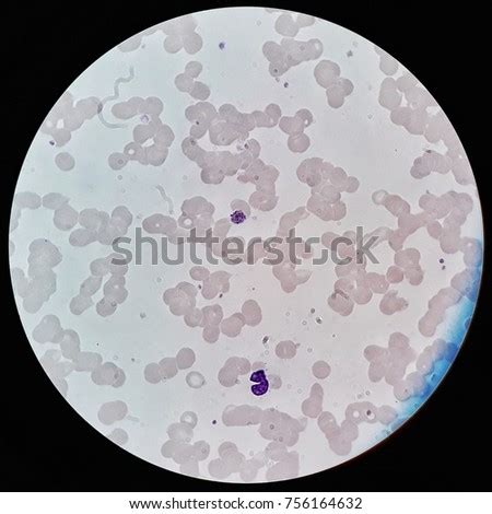 Plasmodium Stock Images, Royalty-Free Images & Vectors | Shutterstock