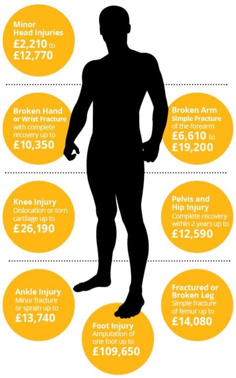 Personal Injury Calculator How Much Could You Claim Paul Crowley