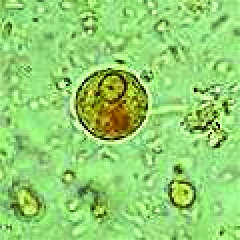 Entamoeba Histolytica Nuclei