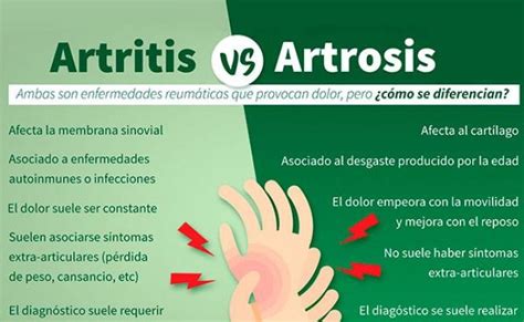 Artrosis O Artritis Causas Sintomas Y Tratamiento Theme Loader