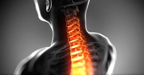 Cervical Skeletal Traction