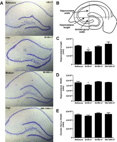 (A) Photomicrographs (40 × magnification) of the hippocampus of adult ... 