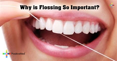 Why is Flossing So Important? - PositiveMed