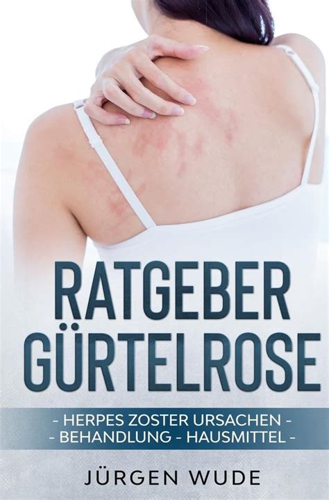 Ratgeber G Rtelrose Herpes Zoster Ursachen Behandlung Hausmittel