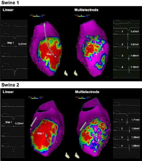 Electroanatomic Clinical Maps Eam Of The Left Ventricle In A