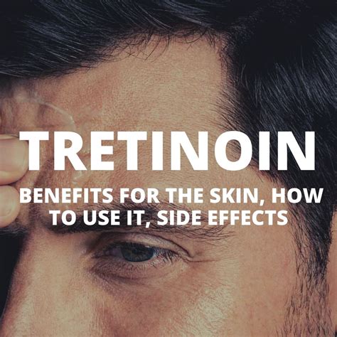 Tretinoin: Benefits for the skin, how to use it, side effects - SIXMD ...