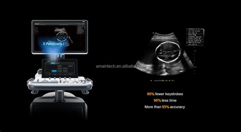 China Sonoscape S60 4d Trolley Diagnosis Ultrasound System Factory And