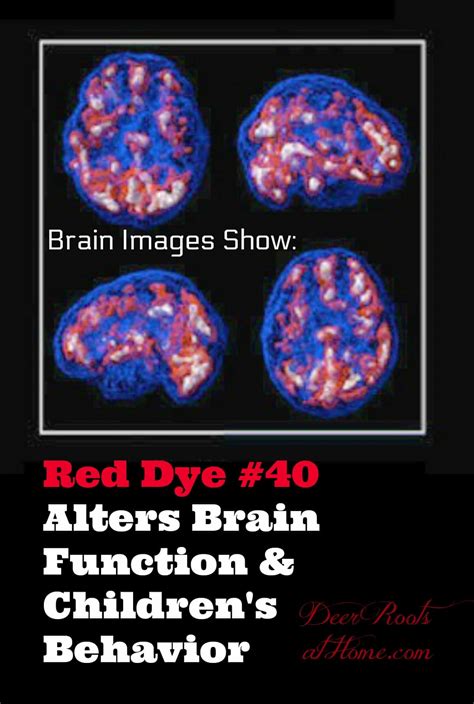 Red Dye #40 Can Make Non-ADD Kids Hyperactive & Alter Brain Function