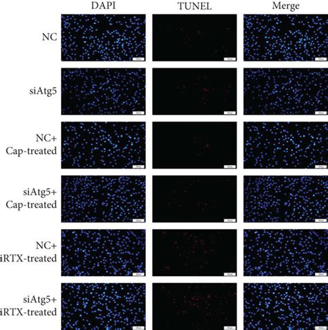 Trpv And Apoptosis Atg Mediated Autophagy In Ogd R Microglia