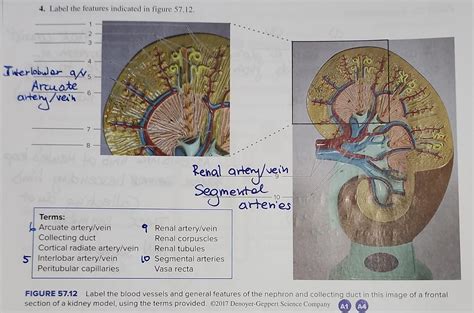 Solved Label The Features Indicated In Figure Chegg