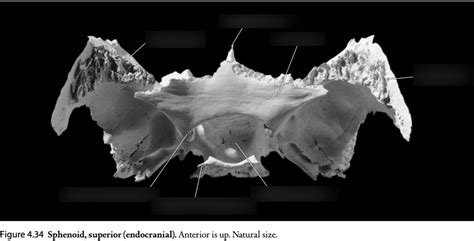 Anth 414 Quiz 1 Sphenoid Bone Superior View Diagram Quizlet