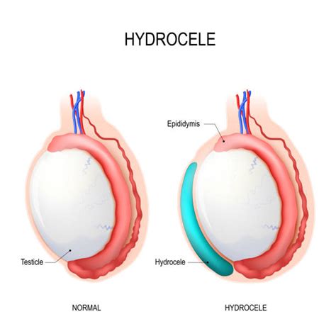 1 100 Testicule Stock Illustrations Graphiques Vectoriels Libre De