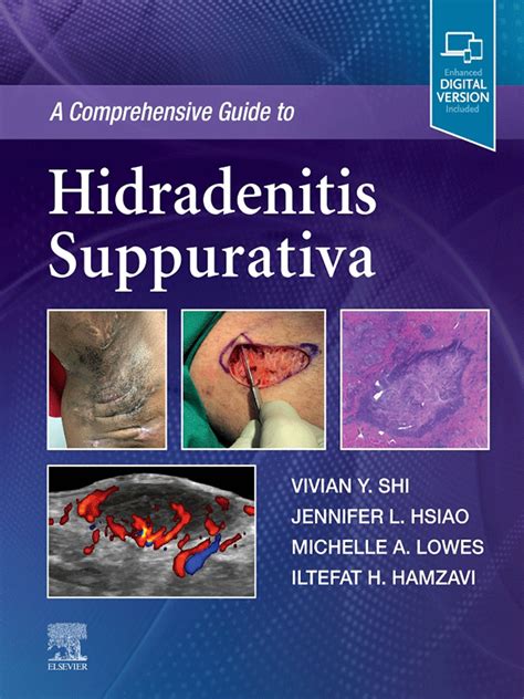 Understanding Hs Skin A Comprehensive Guide To Hidradenitis