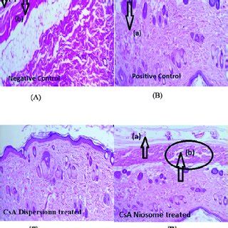 Histopathology Of Mice A Normal Negative Control L Mice Skin Showing