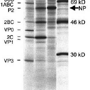 Replication Of Subgenomic Poliovirus Genome Derived Replicons HeLa