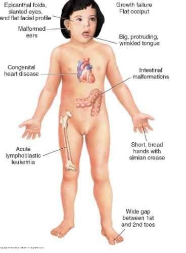 Genetic Basis Of Disease Flashcards Quizlet