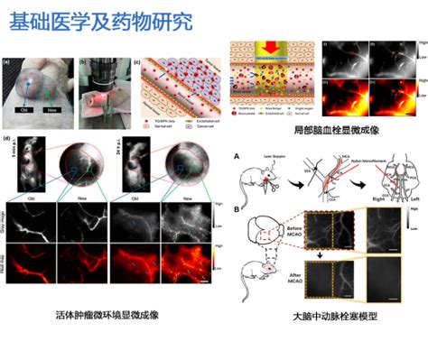 近红外二区显微影像系统NIR MS系列 局部脑血栓成像 AIE纳米颗粒活体研究 活体肿瘤微环境显微成像 近红外成像 罗辑科学 罗辑科学 罗辑