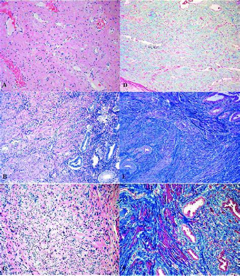 Hematoxylin Eosin And Masson S Trichrome Stained Sections Of Human