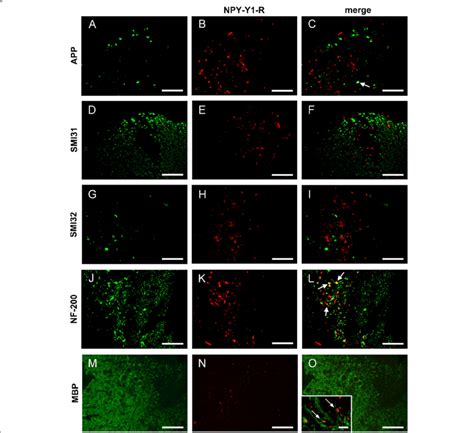 NPY Y1R Does Not Co Localize With Markers Of Axonal Transport