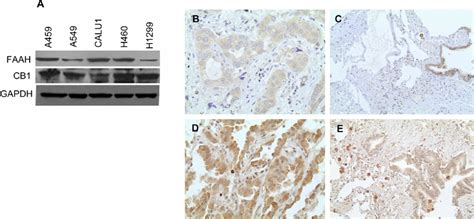 Nsclc Cell Lines And Primary Lung Cancer Tissues Express Cb1 And Faah