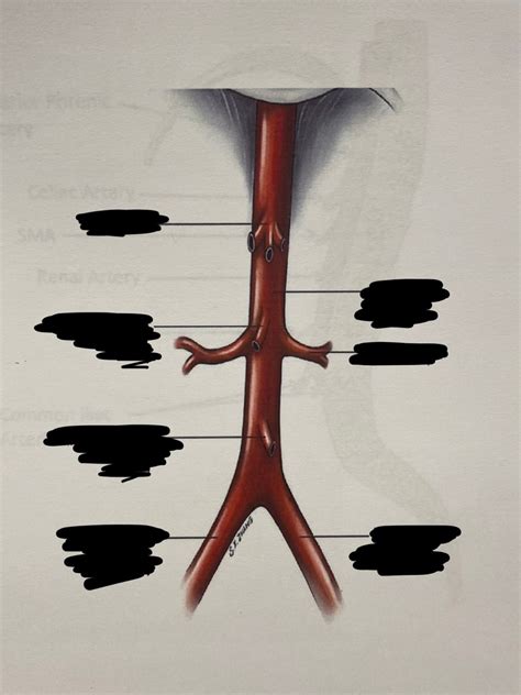 Abdominal Aorta Diagram | Quizlet