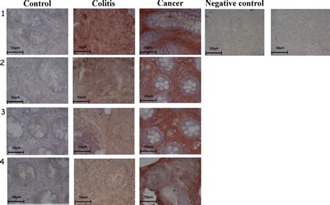 Immunohistochemical Analysis Of Inos Expression Of Epithelium Colon