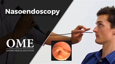 ENT - Nasoendoscopy - Oxford Medical Education