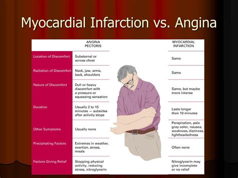 Angina Vs Myocardial Infarction