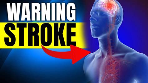 Protect Your Health Learn The Warning Signs Of A Stroke Youtube