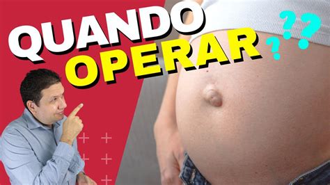 Aprender Sobre Imagem H Rnia Umbilical Fotos Br Thptnganamst Edu Vn