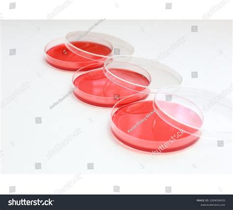 Microbiology Bacteriology Culture Plates Laboratory Stock Photo ...