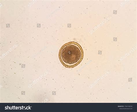 Toxocara Cati Egg Under Microscope Stock Photo 1794198355 | Shutterstock