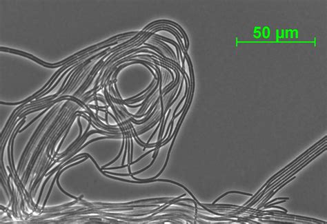 Of Bacteria and Men: Filamentous bacteria under the microscope