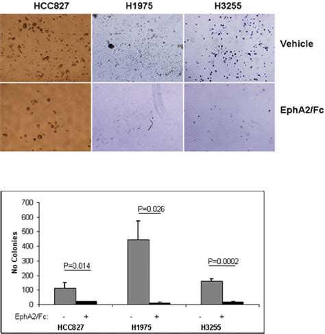 Epha Fc Inhibits Nsclc Anchorage Independent Growth Representative