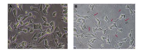 Neuronal Differentiation RA Induced Neuronal Differentiation And