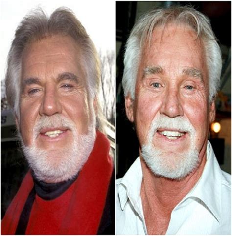 Kenny Rogers Before And After Top 15 Celebs With Plastic Surgery