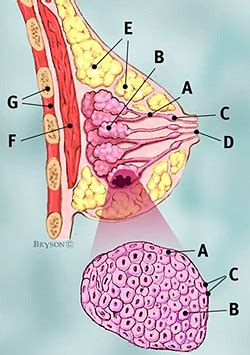 Lobular Breast Cancer in Situ in Guwahati | ID: 7191923530