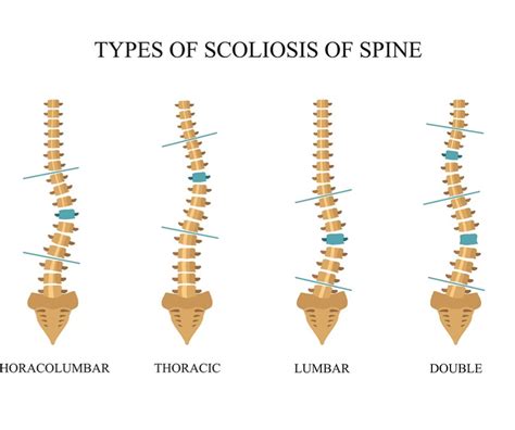 Spine Anatomy Scoliosis