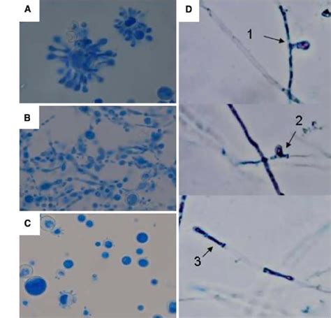 Elongated Yeasts Of P Brasiliensis Isolates T10 And Bt84 A And B