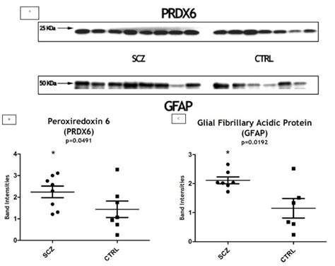 A Western Blot Profiles Of Prdx And Gfap In The Dorsolateral